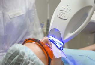 Отбеливание зубов по специальной цене