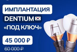 Имплантация зубов — 45 000 ₽