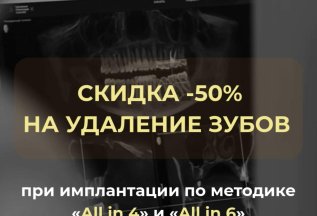 Скидка 50% на удаление зубов при имплантации