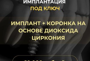 Имплантация под ключ