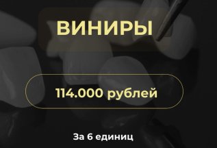 Виниры 114.000 за 6 едениц