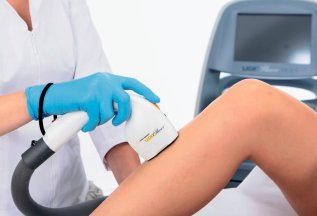 Лазерная эпиляция на аппарате -30%