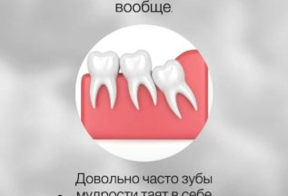 Нужно ли удалять зубы мудрости и зачем❓