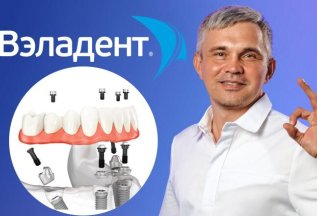 Имплантация зубов Osstem (Корея) — от 19700 ₽