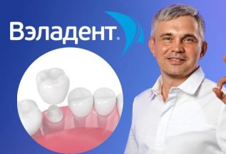 Экспертная диагностика по имплантации + 3D-снимок – 1590₽