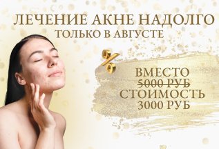 Лечение акне надолго весь август по специальной цене!