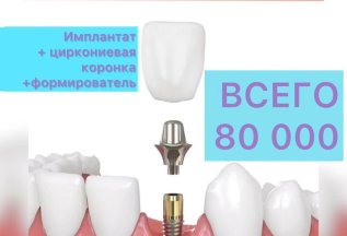 АКЦИЯ