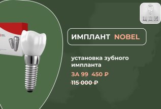 Имплант 
