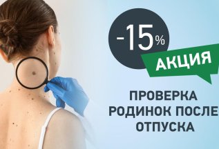 Проверка родинок после отпуска