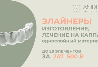 Элайнеры. Изготовление, лечение на каппах за 247 500 Р
