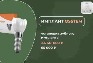 Установка дентального импланта OSSTEM за 46 400 Р