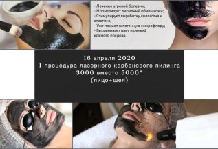 1 процедура карбонового пилинга - 5000 рублей (лицо).