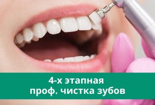 Профессиональная чистка зубов - 3000 руб.
