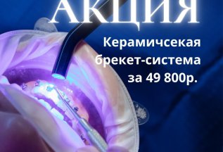 Брекет-система (керамическая) 49 800 ₽