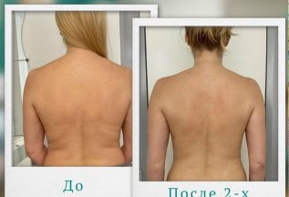 💫 Хотите чёткий силуэт и ровную осанку?