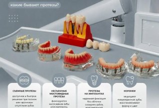 🦷 ПРОТЕЗИРОВАНИЕ ЗУБОВ