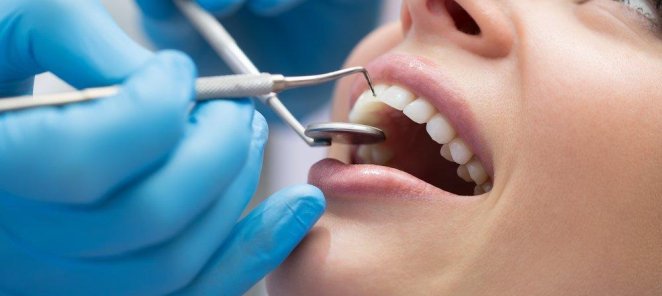 Скидка 10% на терапевтическое лечение зубов