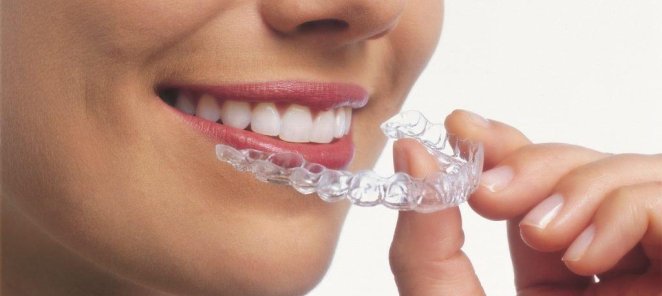 В нашей стоматологии есть Invisalign