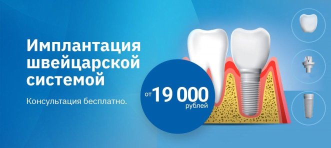 Имплантация швейцарской системой от 19 000 рублей.