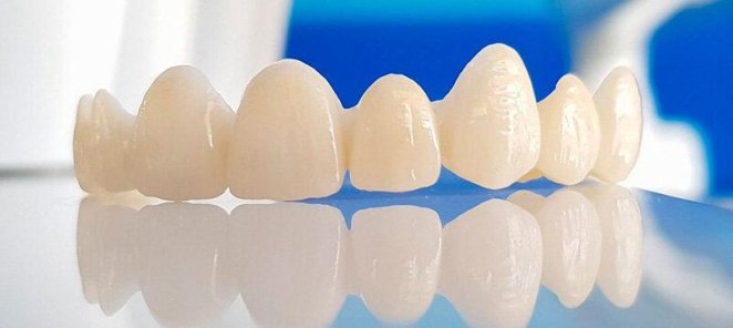 Коронка из диоксида циркония под ключ за 12000 руб.