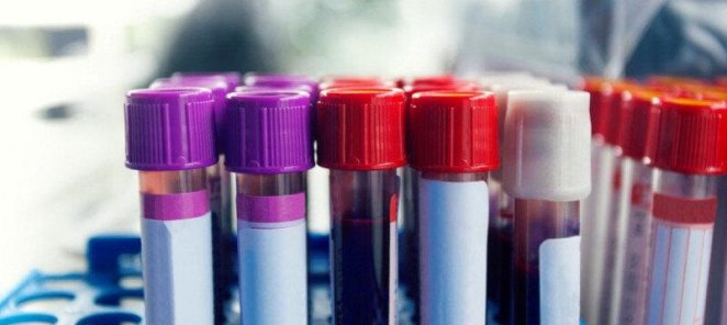 Анализы крови: биохимия крови, гормоны, аллергены и т.п.