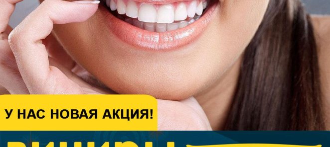 Скидка 20% на стоимость виниров под ключ!