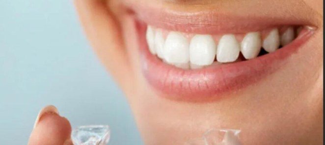 Элайнеры - прозрачная система для выравнивания зубов