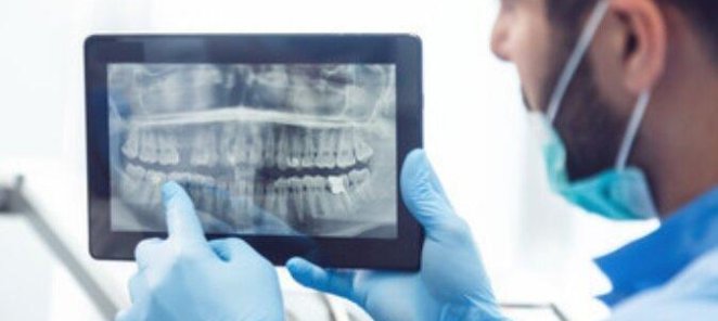Консультация имплантолога + компьютерная 3D-томография зубов