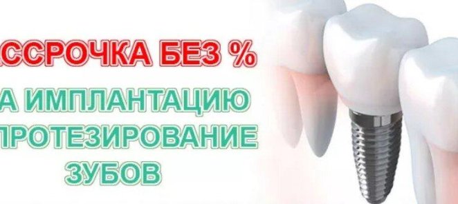 Рассрочка на имплантацию!