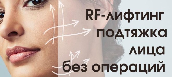 RF лифтинг лица
