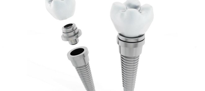 Имплант под ключ Dentium(Корея) 30000 р. В АВГУСТЕ 25 года.