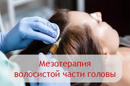 Мезотерапия волос и головы