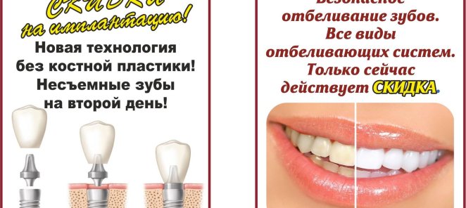 имплантация