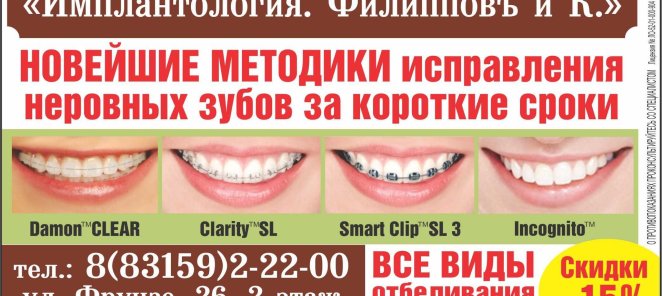 брекеты