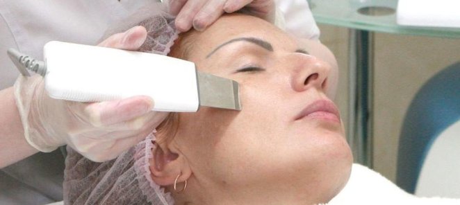 Чистка лица Атравматичная - 2500 рублей