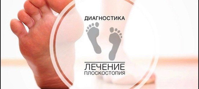 Ортопедические стельки - диагностика плоскостопия в падарок