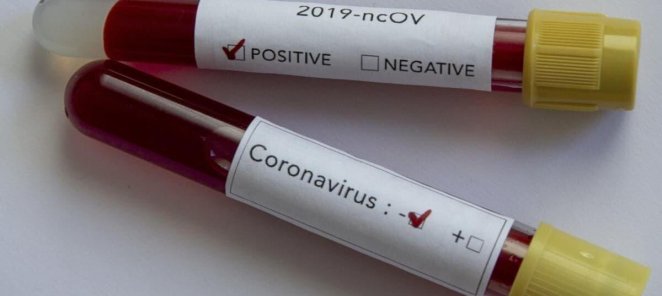 Covid-2019(пцр)1600 рублей