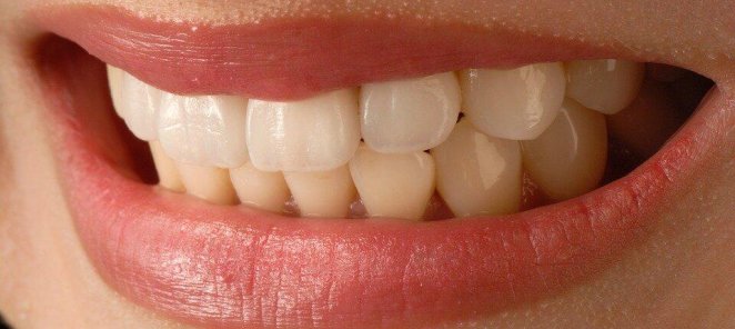 Профессиональная гигиена зубов со скидкой