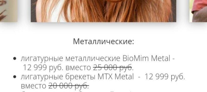 Скидки на брекеты
