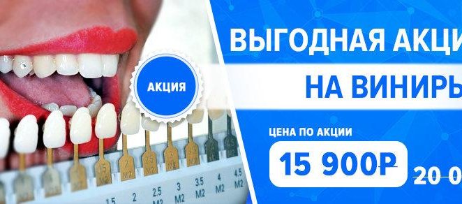 Скидка 20% на Виниры