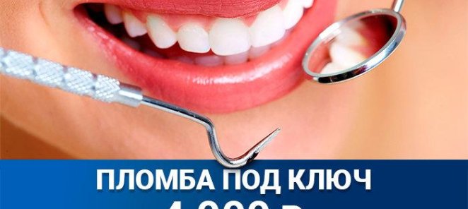 Пломба под ключ за 4000 рублей