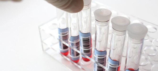 Комплекс анализов: «Перед операцией» - 5500 рублей