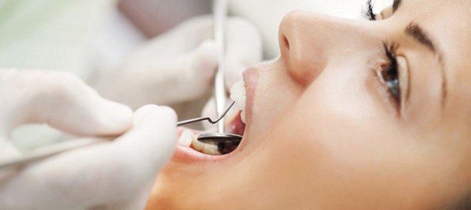 Удаление зубных отложений и пигментного налета ультразвуком
