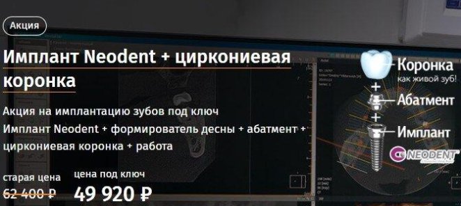 Имплант Neodent + циркониевая коронка за 49 920 рублей!