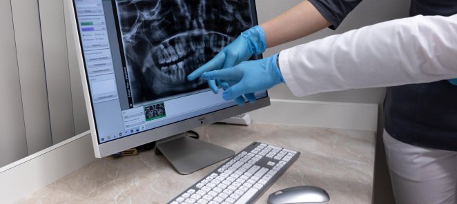 Компьютерная томография полости рта