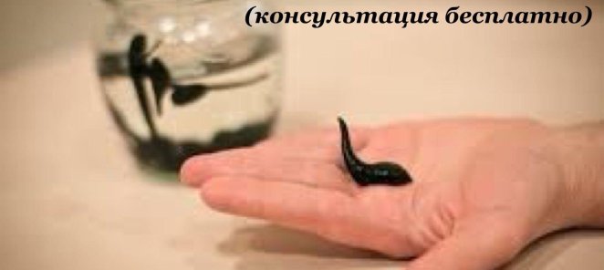 Гирудотерапия (пиявки)