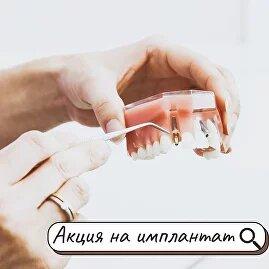 Постановка имплантата Dentium всего 30.000 рублей