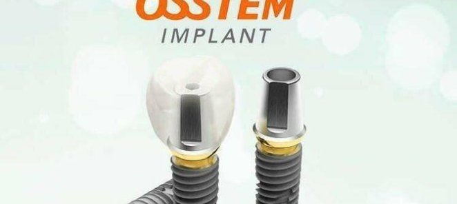 Имплант с установкой Osstem (Корея)