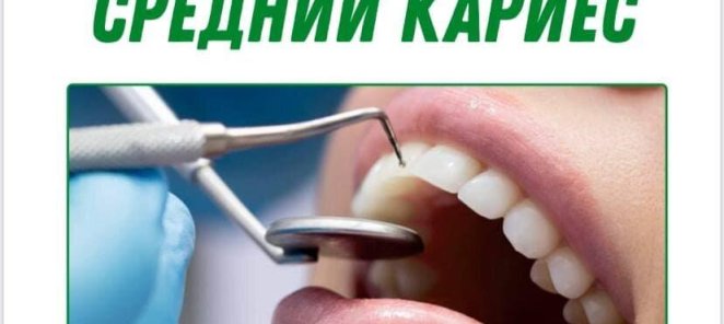 Средний кариес