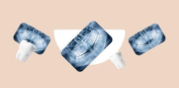 Консультация с 3D-снимком и планом лечения — 1500₽